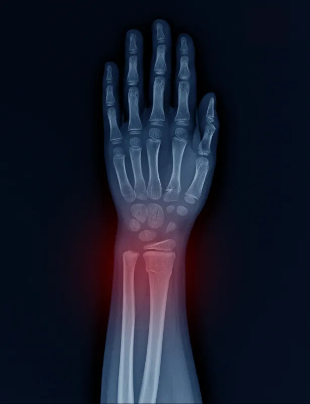Chirurgia della mano Foggia - Dr. Roberto Gabrieli